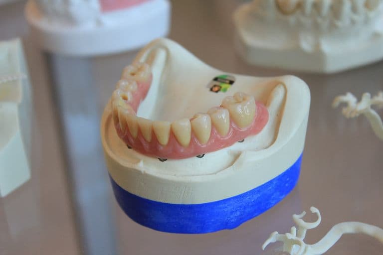 Een volledige onderprothese op een gipsmodel van de kaak